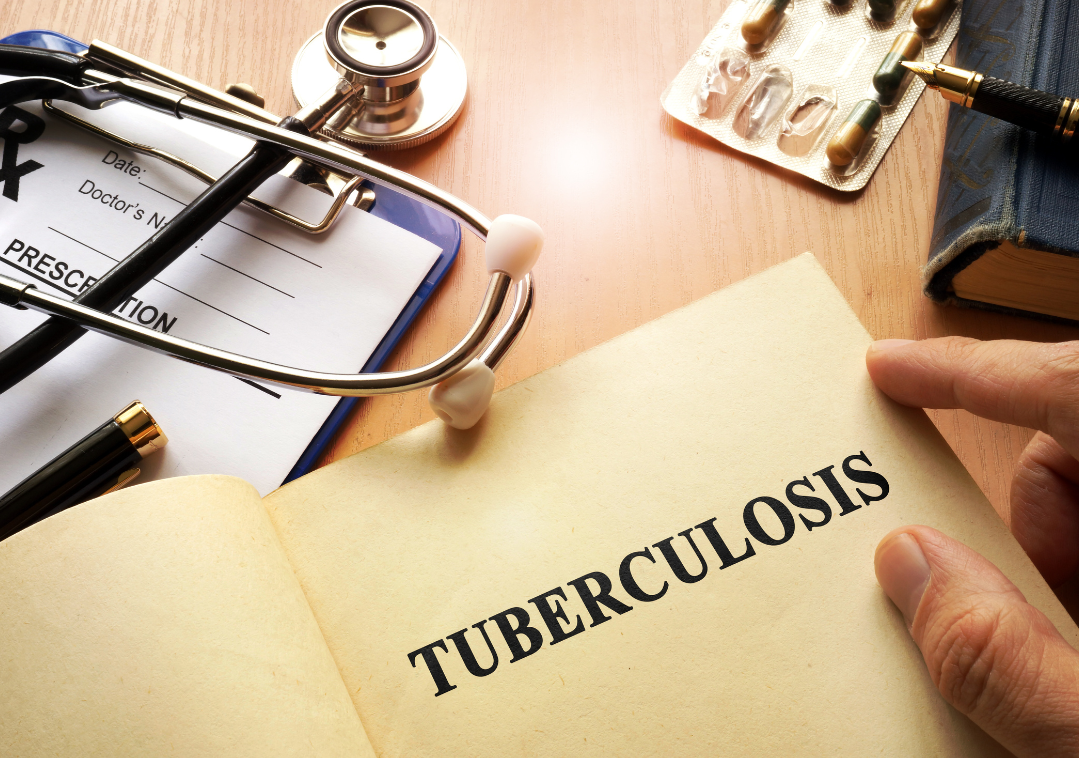 Tuberculosis: A Recurring Concern